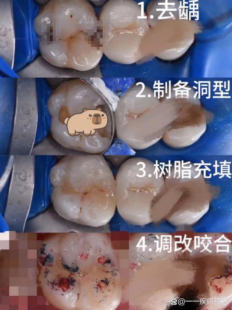 临汾齿科医院的诊疗案例精粹